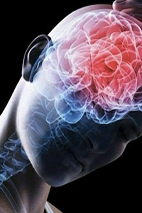 Lesión Cerebral Traumática Lesión Cerebral Traumática